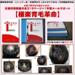 【脱毛解明】ハゲの真実、脱毛を送らせやがて発毛させる方法,レビュー,徹底検証,評価,評判,情報商材,激安,キャッシュバック,豪華特典付